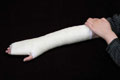 Orthopedic Fiberglass Casting Splint