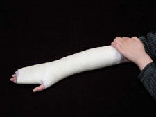 Orthopedic Fiberglass Casting Tapes 4 Orthopedic Fiberglass Casting Tapes